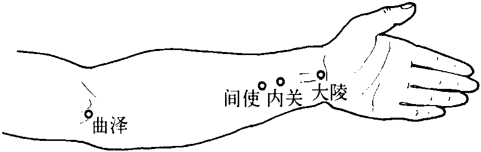 二、手厥陰